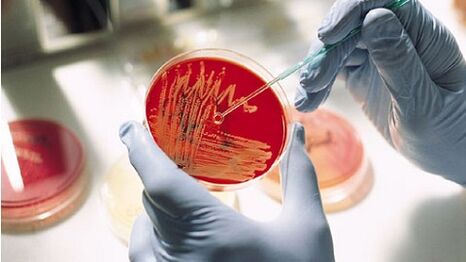 coltura batterica per prostatite per prescrivere antibiotici