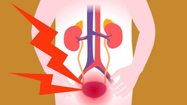 dolore nella zona della vescica con prostatite acuta
